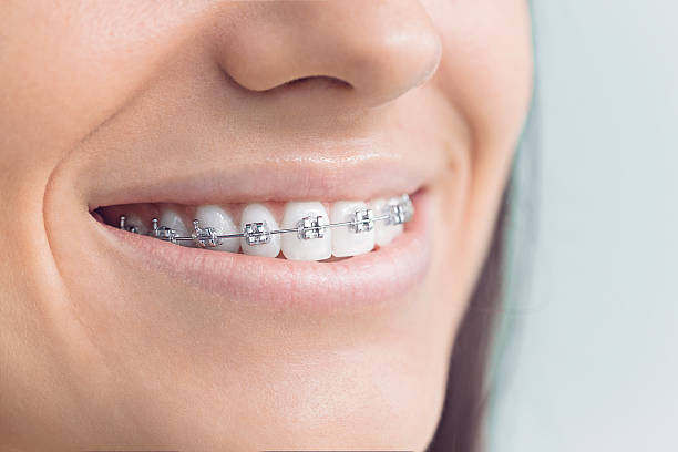 Best Traditional Braces  in Carbondale, CO